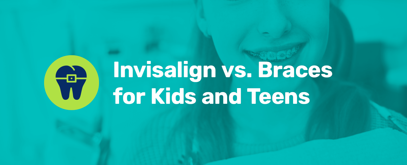 Invisalign Vs. Braces: Differences, Treatment Time And Benefits