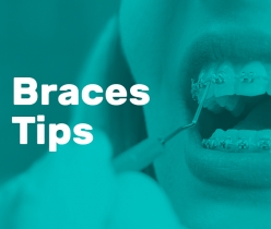 braces tips
