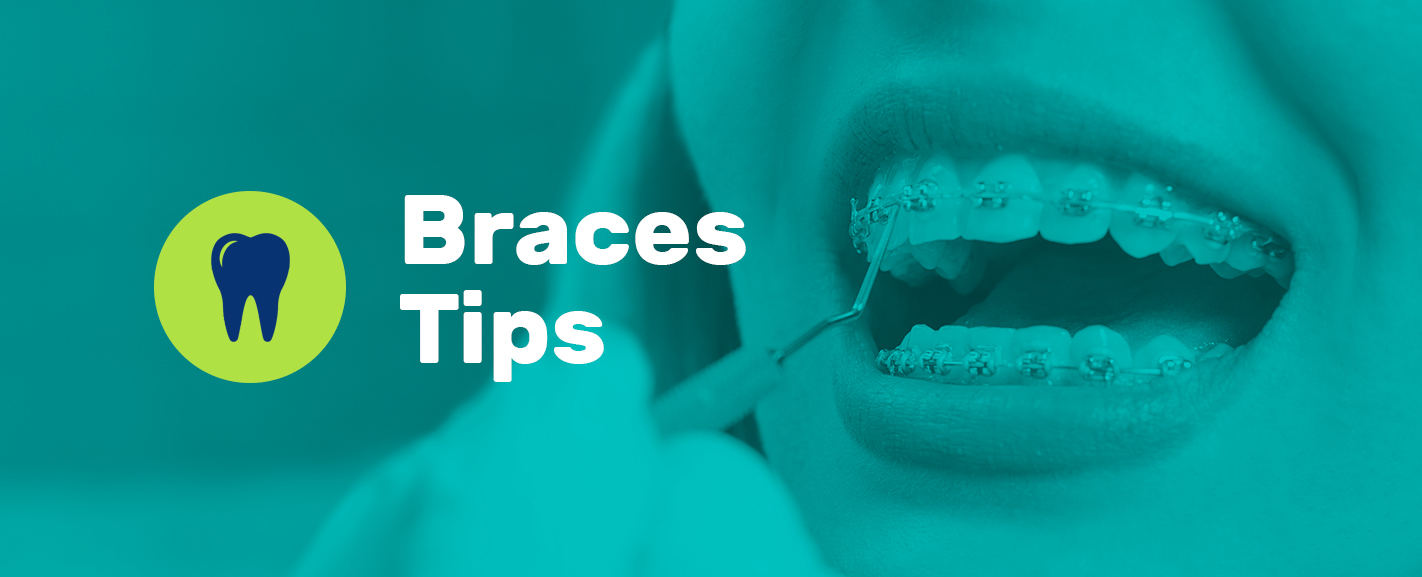 braces tips