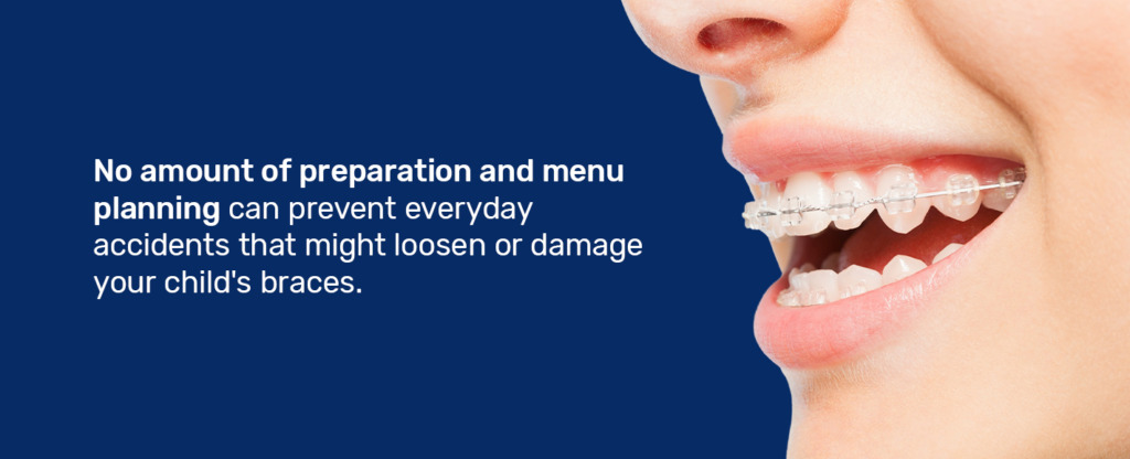 No amount of preparation and menu planning can prevent everyday accidents that might loosen or damage your child's braces