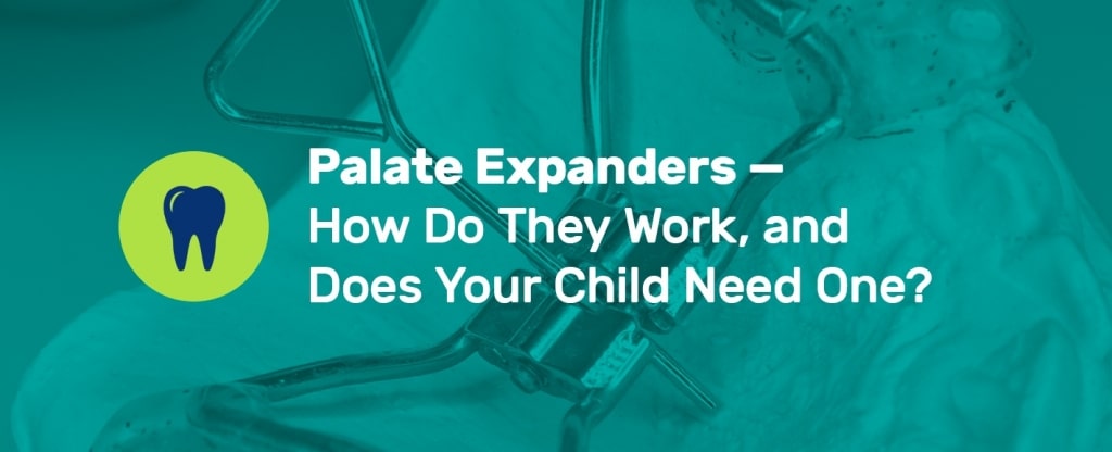 What to Expect With Your Child's Orthodontic Expander