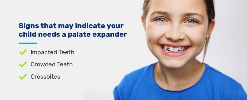 Why does my child need a palatal expander?